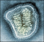 A Cross Section of an Influenza Virion, note the peplomeres around the outside